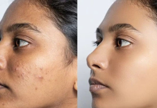 Brightening & Glow Treatments