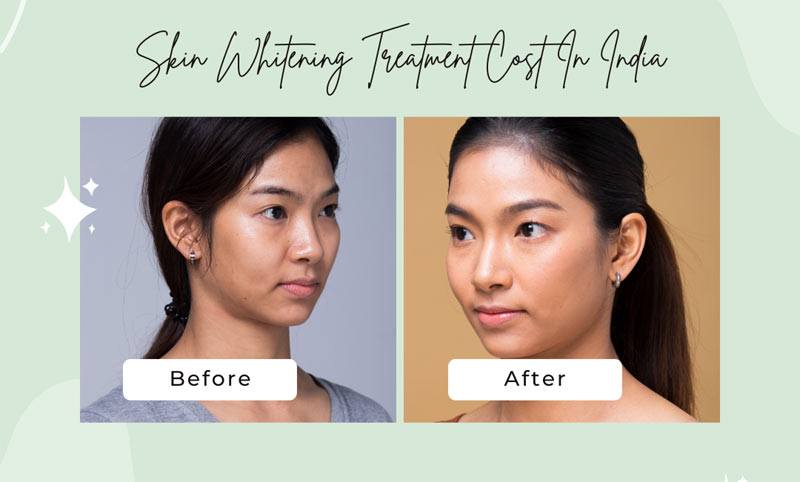 Brightening & Glow Treatments