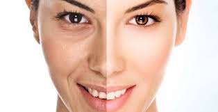 Anti-Aging Treatments